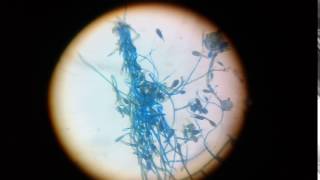 epidermophyton floccosum structure under 45x compound microscope [upl. by Anel41]