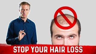 A Major Hidden Reason for Hair Loss Especially Alopecia – Biotin Deficiency – DrBerg [upl. by Dnaltiak]