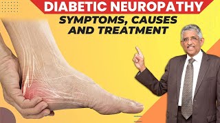 What Causes Diabetic Neuropathy  Peripheral Neuropathy  Dr V Mohan [upl. by Nylhtac]