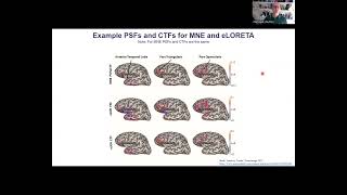 The spatial resolution of linear EEGMEG source estimation [upl. by Caddaric161]