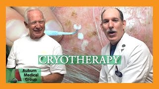 Actinic Keratosis Frozen with Cryotherapy  Auburn Medical Group [upl. by Animar]