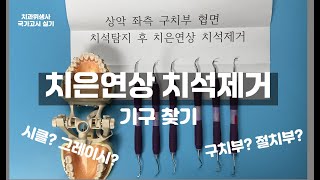 치과위생사 국가고시 실기  상악 좌측 구치부 협면 치석탐지 후 치은연상 치석제거  시클 스켈러 sickle scaler 찾기  기구 찾기 팁  에듀식스 [upl. by Ayekram]