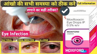 moxiford eye drop review  moxifloxacin  uses and benifits  how to use  in hindi [upl. by Radbourne352]