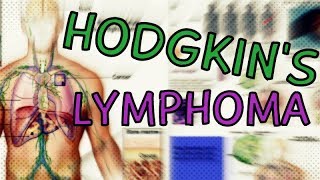 Hodgkins Lymphoma  Types  Symptoms  Staging  Treatment  Diagnosis Hodgkins Lymphoma Explained [upl. by Eugor]