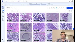 Snowflake and Landing AI Collaborate to Make Complex Diagnoses Easy [upl. by Velvet]