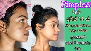 දවස් 14න් Pimples අඩු කරන්න මම Use කරපු නිශ්පාදන How I got Rid of Pimples  Pimples Remove at home [upl. by Schacker]