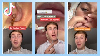 The Most Satisfying TikTok Pimple Popping Reactions Compilation [upl. by Dede]