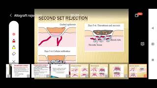 Mechanism of Graft Rejection  Allograft Rejection  Type IV Hypersensitivity [upl. by Hiroko]