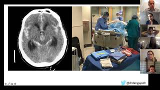 Medical Student Lecture Series  Neurocritical Care [upl. by Nolyk]