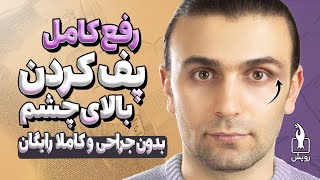 رفع پف پلک بالای چشم با حرکات و ماساژهای خانگی  Swollen eyelid treatment at home [upl. by Koo]