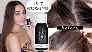 I USED The Inkey List Salicylic Acid Exfoliating Scalp Treatment FOR 2 MONTHS TEST  HONEST REVIEW [upl. by Nediarb]