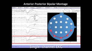 Introduction to EEG [upl. by Romney]