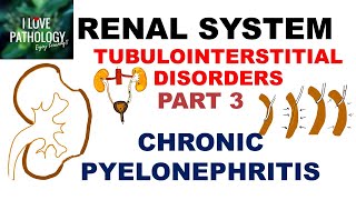 CHRONIC PYELONEPHRITIS  PATHOLOGY [upl. by Euseibbob658]