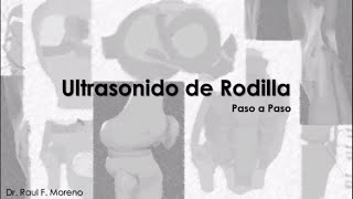 Ultrasonido de Rodilla paso por paso [upl. by Curry]