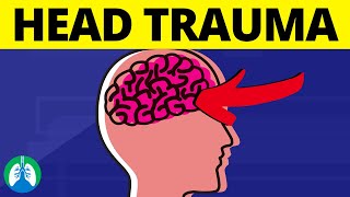 Head Trauma 🧠 Quick Medical Overview  Traumatic Brain Injury [upl. by Altheta665]