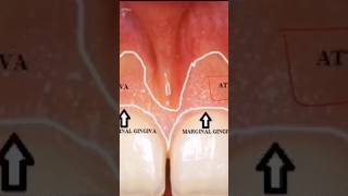 Important topicjunctional epitheliumwatch full video on our channel [upl. by Ydnir598]