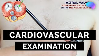 Cardiovascular Examination  OSCE Guide  UKMLA  CPSA [upl. by Bell]