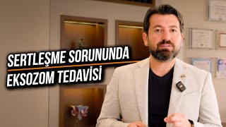 SERTLEŞME SORUNDA YENİ NESİL TEDAVİ EKSOZOM [upl. by Aratehs906]