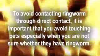 How Do You Get Ringworm [upl. by Tram]