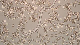 Dirofilaria immitis  microfilaria 400x [upl. by Dnomasor]