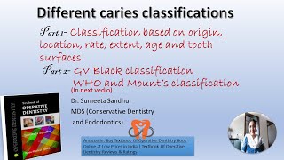 Dental caries classification Part 1 [upl. by Baudoin]