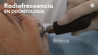 RADIOFRECUENCIA en odontología ¿Qué ventajas tiene [upl. by Anaeli919]