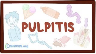 Pulpitis  causes symptoms diagnosis treatment pathology [upl. by Hesler685]