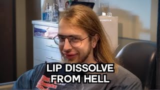 Lip Filler Dissolve Gone Wrong 😱  OKAY REALLY [upl. by Yim]