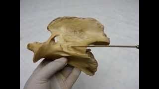 Cervical vertebrae by dr khaled shoghy [upl. by Akfir825]