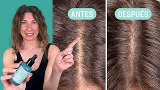 7 trucos para TRATAR y prevenir la CAÍDA del cabello 🌱  Freshly Cosmetics 🌿 [upl. by Wye469]