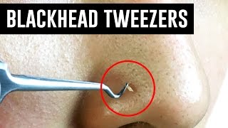 Tweezers That Remove Blackheads TINA TRIES IT [upl. by Artenahs]