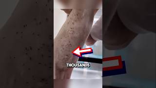 Extremely satisfying bug removal 😱 shorts oddlysatisfying [upl. by Suixela865]