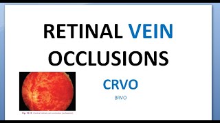 Ophthalmology CRVO Central Retinal Vein Occlusion Splashed tomato Thunder Ischemic RAPD glaucoma [upl. by Silver]