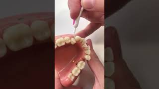 Using an Interdental Brush 2 [upl. by Nezah58]