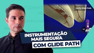 Glide Path O que é e como inserir na sua instrumentação [upl. by Utley]