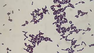 Gram staining of Enterococcus [upl. by Dowd]