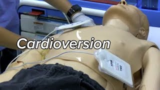 Cardioversion  Defibrillation Technique [upl. by Notle]