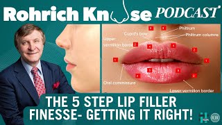 The 5 Step Lip Filler Finesse Getting it Right [upl. by Nanreik]