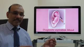 Hematoma auris Tamil Patient teaching programme [upl. by Nawud]