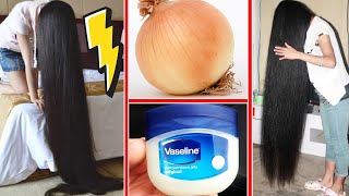 Bis zu 2 cm pro TAG 😱 Haarwachstum durch Vaseline und Zwiebel 👧 [upl. by Richmound]