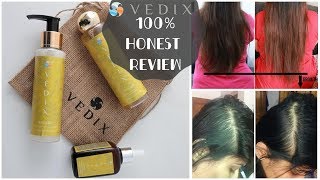 I tried VEDIX for 1 Month  100 Honest Non Sponsored VEDIX Review  Customised Hair Routine  Kavya [upl. by Valerie]