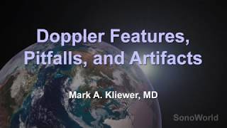 Doppler Features Pitfalls and Artifacts [upl. by Chapland]