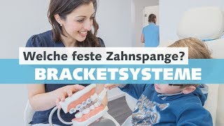 Feste Zahnspange  Bracketsysteme beim Kieferorthopäden  Welche Arten und Vorteile gibt es [upl. by Eiznikam]