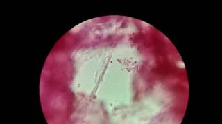 Biology Experiment  Rhizobium  The Nitrogen Fixing bacteria under Microscope [upl. by Neetsirk660]