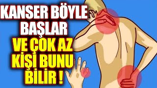 Kanser Olduğunuzu Gösteren 20 İşaret  Bu Belirtilerden Biri Bile Varsa Hemen Doktora Gidin [upl. by Nimref827]