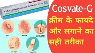 Cosvate G Cream Uses In Hindi  Clobetasol Propionate And Gentamicin Cream  Uses Side Effects [upl. by Eberhard]