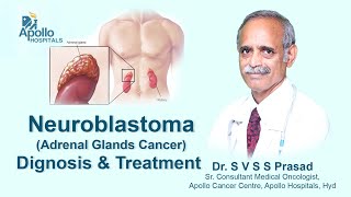 Neuroblastoma  Diagnosis amp Treatment  Dr SVSS Prasad Medical Oncologist  Apollo Hospital [upl. by Yarod]