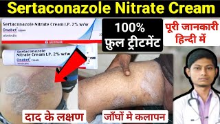 Sertaconazole nitrate cream 2 ww  sertaconazole cream  onabet cream kis kaam aati hai [upl. by Mukul]