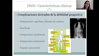 Sopnia Curso Actualización en Enfermedades Neuromusculares Capitulo 4 [upl. by Laddy]