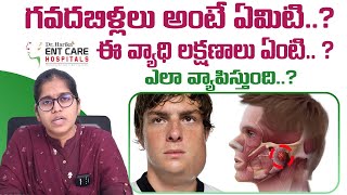 గవదబిళ్లలు అంటే ఏమిటి  Acute Parotitis or Mumps in Telugu  Dr Harika ENT Care Hospital [upl. by Connel638]